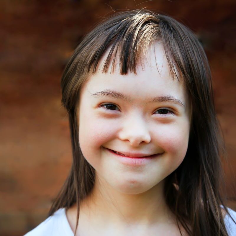 Smiling girl with special needs at a dental office in San Francisco, California.